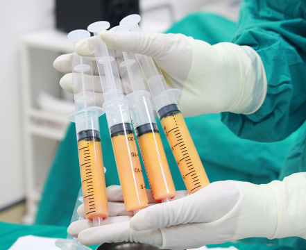 تزریق چربی و موارد مصرف و مزایا و مراقبتهای بعد از عمل | دکتر آراز معین متخصص جراحی عمومی ، لاپاراسکوپی و زیبایی