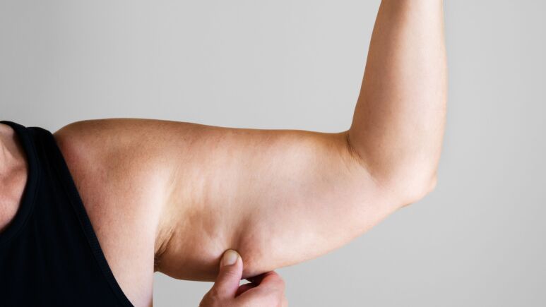 براکیوپلاستی