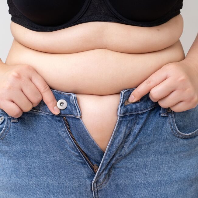 اسلیوگاسترکتومی